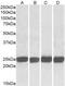 Growth Factor Receptor Bound Protein 2 antibody, GTX22234, GeneTex, Western Blot image 