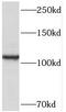 RelA-associated inhibitor antibody, FNab06702, FineTest, Western Blot image 