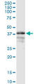 LON peptidase N-terminal domain and RING finger protein 1 antibody, LS-C139282, Lifespan Biosciences, Western Blot image 