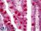 PTC1 antibody, LS-B6565, Lifespan Biosciences, Immunohistochemistry paraffin image 