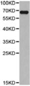 Kelch Like ECH Associated Protein 1 antibody, TA321818, Origene, Western Blot image 