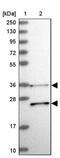 Retinol Dehydrogenase 13 antibody, PA5-59818, Invitrogen Antibodies, Western Blot image 