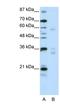 Zinc Finger Protein 440 antibody, NBP1-80404, Novus Biologicals, Western Blot image 