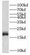 Spermatogenesis Associated 19 antibody, FNab08160, FineTest, Western Blot image 