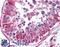 Peptidyl-TRNA Hydrolase 2 antibody, LS-B1392, Lifespan Biosciences, Immunohistochemistry paraffin image 