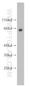 Pantothenate kinase 1 antibody, 11768-1-AP, Proteintech Group, Western Blot image 