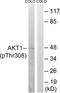 Akt antibody, TA313258, Origene, Western Blot image 