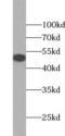 Galactosidase Alpha antibody, FNab00330, FineTest, Western Blot image 