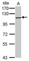 Pre-MRNA Processing Factor 6 antibody, NBP2-19965, Novus Biologicals, Western Blot image 