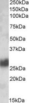 Thy-1 Cell Surface Antigen antibody, orb20021, Biorbyt, Western Blot image 