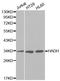 Had antibody, orb48995, Biorbyt, Western Blot image 