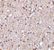BR Serine/Threonine Kinase 2 antibody, LS-C19697, Lifespan Biosciences, Immunohistochemistry paraffin image 