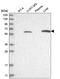 Carnitine O-Acetyltransferase antibody, HPA022815, Atlas Antibodies, Western Blot image 