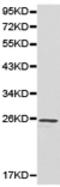 Ubiquitin Conjugating Enzyme E2 K antibody, TA323779, Origene, Western Blot image 