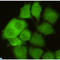 Cyclin Dependent Kinase 1 antibody, LS-C812908, Lifespan Biosciences, Immunocytochemistry image 