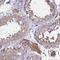 Growth Factor Receptor Bound Protein 14 antibody, HPA035053, Atlas Antibodies, Immunohistochemistry paraffin image 