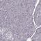 Ectonucleoside Triphosphate Diphosphohydrolase 8 antibody, HPA021509, Atlas Antibodies, Immunohistochemistry paraffin image 