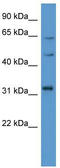 MAP kinase-interacting serine/threonine-protein kinase 1 antibody, TA342919, Origene, Western Blot image 