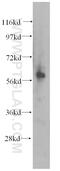 Adhesion Molecule With Ig Like Domain 2 antibody, 14076-1-AP, Proteintech Group, Western Blot image 