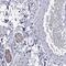 Myelin Protein Zero antibody, NBP2-68878, Novus Biologicals, Immunohistochemistry paraffin image 