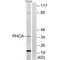 Alkaline Ceramidase 3 antibody, MBS9400931, MyBioSource, Western Blot image 