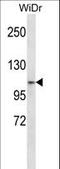 Zinc Finger Protein 836 antibody, LS-C160956, Lifespan Biosciences, Western Blot image 