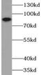 Phosphatidylinositol 3-kinase regulatory subunit alpha antibody, FNab06422, FineTest, Western Blot image 