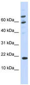 Putative uncharacterized protein encoded by NCRNA00257 antibody, TA338908, Origene, Western Blot image 