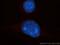 Exosome Component 8 antibody, 11979-1-AP, Proteintech Group, Immunofluorescence image 