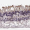 Regulator Of G Protein Signaling 9 Binding Protein antibody, HPA049791, Atlas Antibodies, Immunohistochemistry frozen image 