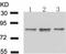 Inhibitor of nuclear factor kappa-B kinase subunit alpha antibody, TA321323, Origene, Western Blot image 