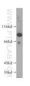 Aldehyde Dehydrogenase 18 Family Member A1 antibody, 17719-1-AP, Proteintech Group, Western Blot image 