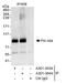 DNA Polymerase Iota antibody, A301-304A, Bethyl Labs, Immunoprecipitation image 