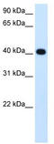 ADH4 antibody, TA332357, Origene, Western Blot image 