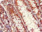 RHOH antibody, LS-C395148, Lifespan Biosciences, Immunohistochemistry paraffin image 