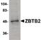 Zinc Finger And BTB Domain Containing 1 antibody, PA5-20659, Invitrogen Antibodies, Western Blot image 
