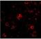 Nanos C2HC-Type Zinc Finger 3 antibody, NBP1-76919, Novus Biologicals, Immunocytochemistry image 