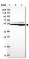 Suppression Of Tumorigenicity 5 antibody, PA5-61331, Invitrogen Antibodies, Western Blot image 