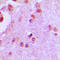 Minichromosome Maintenance Complex Component 5 antibody, LS-C352495, Lifespan Biosciences, Immunohistochemistry paraffin image 