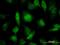 Pre-mRNA-processing factor 19 antibody, H00027339-M07, Novus Biologicals, Immunofluorescence image 