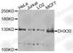 DExH-Box Helicase 30 antibody, A8575, ABclonal Technology, Western Blot image 