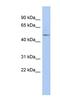 Protoporphyrinogen Oxidase antibody, NBP1-79615, Novus Biologicals, Western Blot image 