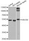 HAUS augmin-like complex subunit 8 antibody, A7847, ABclonal Technology, Western Blot image 