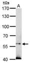 Suppressor of cytokine signaling 5 antibody, LS-C185649, Lifespan Biosciences, Western Blot image 