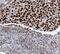 Histone-binding protein RBBP4 antibody, FNab07150, FineTest, Immunohistochemistry paraffin image 