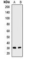 Small Nuclear Ribonucleoprotein Polypeptide B2 antibody, orb412832, Biorbyt, Western Blot image 