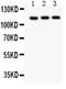 Transient Receptor Potential Cation Channel Subfamily C Member 5 antibody, PB9271, Boster Biological Technology, Western Blot image 