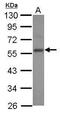 E2F Transcription Factor 3 antibody, PA5-27670, Invitrogen Antibodies, Western Blot image 