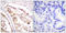 RPA32 antibody, LS-C117924, Lifespan Biosciences, Immunohistochemistry frozen image 