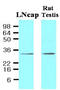 Steap antibody, AM09036PU-S, Origene, Western Blot image 
